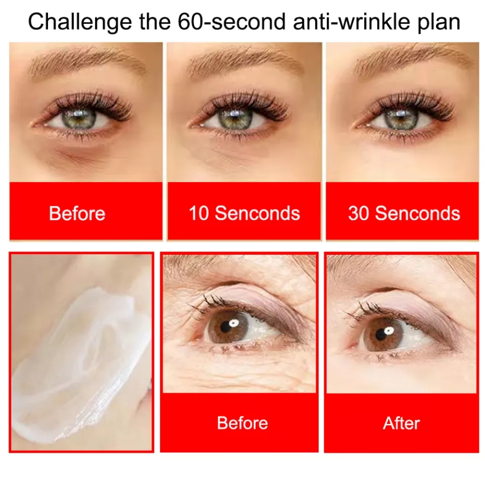 eye-cream-buying-guide-reduce-dark-circles-and-smooth-lines-the